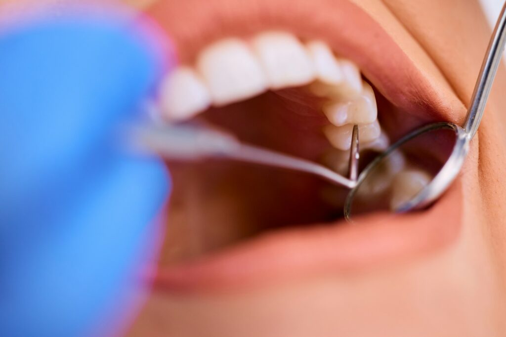 Close up of woman during dental check-up at dentist's office.